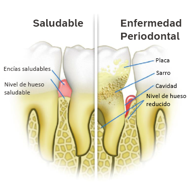 Encías Dentalife